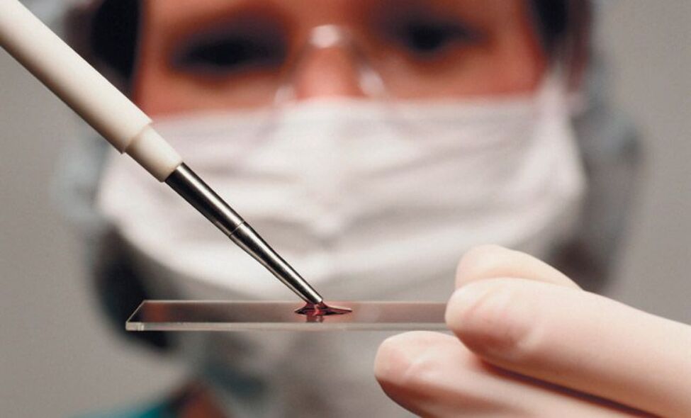 análisis de sangre para parásitos
