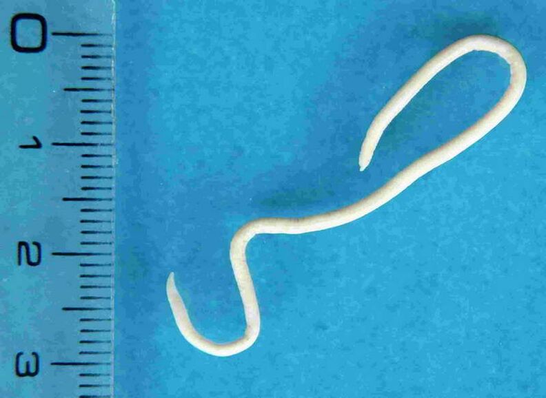 gusano del cuerpo humano