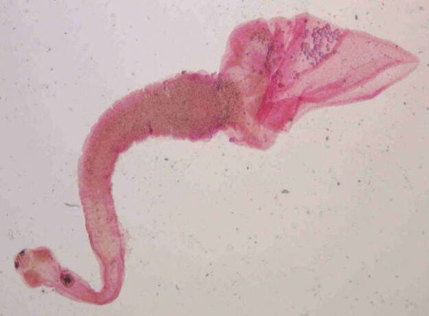 tenia del cerdo de humanos