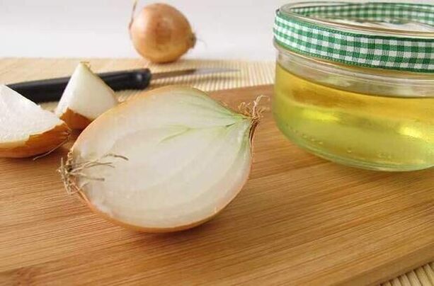 Infusión de cebolla para eliminar lombrices, utilizada durante una semana.